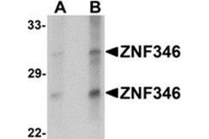 Western blot analysis of ZNF346 in human kidney tissue lysate with ZNF346 antibody at (A) 1 and (B) 2 μg/ml. (ZNF346 antibody  (C-Term))