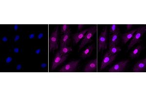anti-Ring-Box 1, E3 Ubiquitin Protein Ligase (RBX1) antibody
