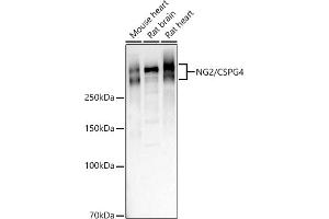 Western blot analysis of extracts of various cell lines, using NG2/CSPG4 antibody (ABIN1679389, ABIN3017852, ABIN3017853 and ABIN5664347) at 1:1000 dilution. (NG2 antibody  (AA 1950-2210))