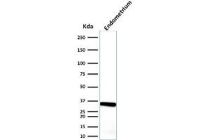 Western Blot Analysis of endometrium using Calponin-1 Mouse Monoclonal Antibody (CALP). (CNN1 antibody)