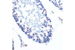 Immunohistochemistry of paraffin-embedded mouse testis using Lamin B1 Rabbit mAb (ABIN7268180) at dilution of 1:100 (40x lens). (Lamin B1 antibody)