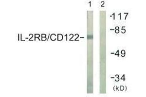 Western blot analysis of extracts from COS7 cells, using IL-2Rβ/CD122 (Ab-364) antibody. (IL2 Receptor beta antibody  (Tyr364))