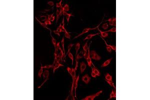 ABIN6277319 staining Hela by IF/ICC. (DBH antibody  (Internal Region))