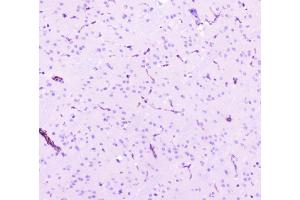 IHC analysis of Caveolin-1/CAV1 using anti-Caveolin-1/CAV1 antibody (ABIN3043803).