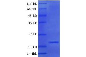 SDS-PAGE (SDS) image for Interferon gamma (IFNG) (AA 24-166) protein (His tag) (ABIN7479106)