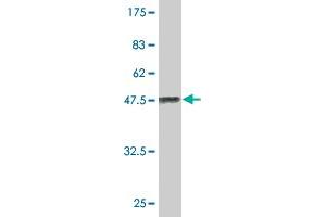 Western Blot detection against Immunogen (41. (MED21 antibody  (AA 1-144))