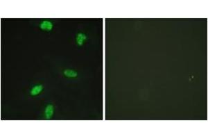 Immunofluorescence analysis of HeLa cells, using Retinoblastoma (Phospho-Thr821) Antibody.