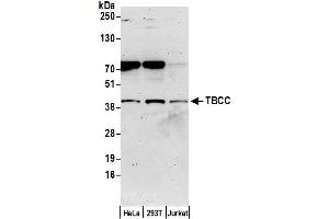 anti-Tubulin Folding Cofactor C (TBCC) (AA 1-50) antibody