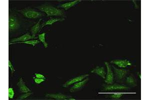 Immunofluorescence of purified MaxPab antibody to CDADC1 on HeLa cell. (CDADC1 antibody  (AA 1-514))
