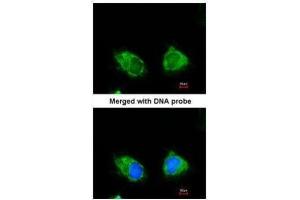 ICC/IF Image Immunofluorescence analysis of paraformaldehyde-fixed HeLa, using INPP1, antibody at 1:200 dilution. (INPP1 antibody)