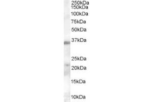 Image no. 1 for anti-Hepatitis A Virus Cellular Receptor 2 (TIM 3) (Internal Region) antibody (ABIN374646)