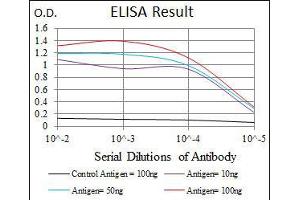 Black line: Control Antigen (100 ng), Purple line: Antigen(10 ng), Blue line: Antigen (50 ng), Red line: Antigen (100 ng), (Hexosaminidase A antibody)