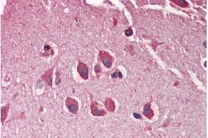 ABIN570801 (5µg/ml) staining of paraffin embedded Human Cortex. (Adlican antibody  (Internal Region))