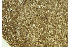 ABIN6273374 at 1/100 staining Mouse pancreas tissue by IHC-P.