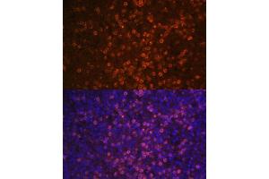 Immunofluorescence (IF) image for anti-Complement Component (3d/Epstein Barr Virus) Receptor 2 (CR2) (AA 300-590) antibody (ABIN6138992)