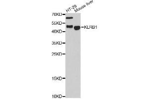 Western blot analysis of extracts of various cell lines, using KLRB1 antibody. (CD161 antibody)