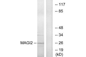 Western blot analysis of extracts from HT-29 cells, using MAGI2 antibody.