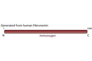 Image no. 3 for anti-Fibronectin antibody (ABIN967729) (Fibronectin antibody)