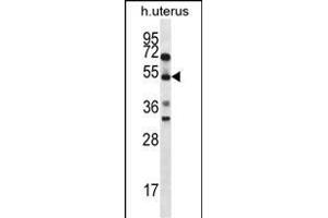 ABRA Antibody (C-term) (ABIN656755 and ABIN2845977) western blot analysis in human normal Uterus tissue lysates (35 μg/lane).