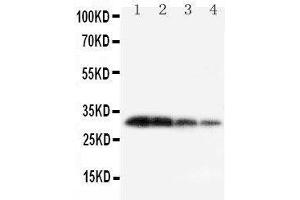 Lane 4: Recombinant Mouse KLK1 Protein 1. (Kallikrein 1 antibody  (C-Term))