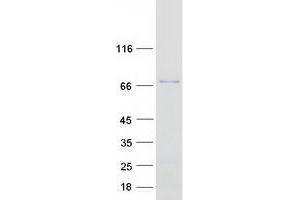 Validation with Western Blot (PICALM Protein (Transcript Variant 1) (Myc-DYKDDDDK Tag))