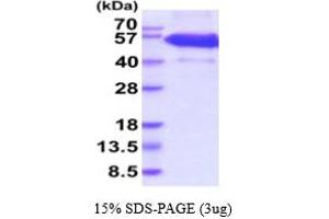 SDS-PAGE (SDS) image for Ectodysplasin A2 Receptor (EDA2R) (AA 1-138) protein (hIgG-His-tag) (ABIN5854822) (Ectodysplasin A2 Receptor Protein (EDA2R) (AA 1-138) (hIgG-His-tag))