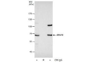 IP Image Immunoprecipitation of RPA70 protein from 293T whole cell extracts using 5 μg of RPA70 antibody [C1C3], Western blot analysis was performed using RPA70 antibody [C1C3], EasyBlot anti-Rabbit IgG  was used as a secondary reagent. (RPA1 antibody  (C-Term))