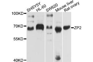Western blot analysis of extracts of various cell lines, using ZP2 antibody. (ZP2 antibody)