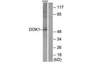 Western blot analysis of extracts from K562 cells, treated with Starvation 24h, using p62 Dok (Ab-398) Antibody. (DOK1 antibody  (AA 365-414))