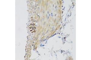 Immunohistochemistry of paraffin-embedded mouse stomach using DGUOK antibody (ABIN5975065) at dilution of 1/100 (40x lens). (Deoxyguanosine Kinase antibody)