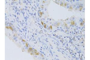 Immunohistochemistry of paraffin-embedded mouse lung using CYP2C9 Antibody.