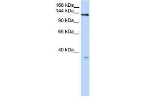 TMEM16C antibody used at 1 ug/ml to detect target protein. (ANO3 antibody  (C-Term))