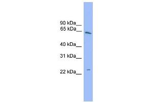 WB Suggested Anti-HSPB8  Antibody Titration: 0. (HSPB8 antibody  (Middle Region))