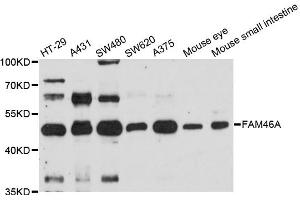 Western blot analysis of extracts of various cell lines, using FAM46A antibody. (FAM46A antibody)
