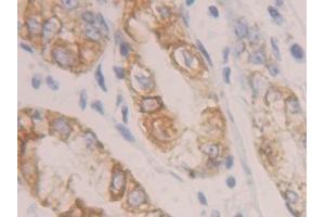 Detection of CK19 in Human Stomach Tissue using Polyclonal Antibody to Cytokeratin 19 (CK19) (Cytokeratin 19 antibody  (AA 245-391))