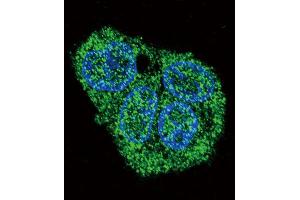 Immunofluorescence (IF) image for anti-Surfactant Protein C (SFTPC) antibody (ABIN2997467) (Surfactant Protein C antibody)
