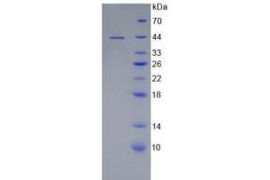 SDS-PAGE analysis of Human MAP2 Protein. (MAP2 Protein)