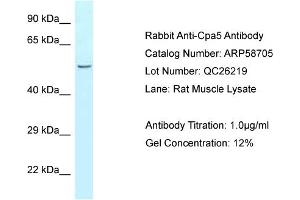Western Blotting (WB) image for anti-Carboxypeptidase A5 (CPA5) (N-Term) antibody (ABIN970440) (CPA5 antibody  (N-Term))