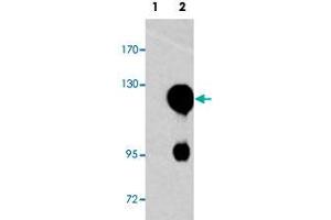 Western blot analysis of ROR2 (arrow) using ROR2 polyclonal antibody . (ROR2 antibody  (N-Term))