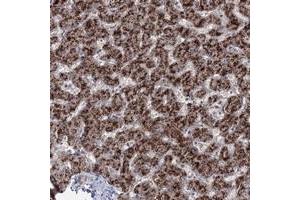 Immunohistochemical staining of human liver with ZFAND6 polyclonal antibody  shows strong granular cytoplasmic positivity in hepatocytes at 1:200-1:500 dilution. (ZFAND6 antibody)