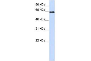 PAPSS2 antibody used at 1 ug/ml to detect target protein. (PAPSS2 antibody  (C-Term))