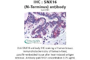 Image no. 1 for anti-Sorting Nexin 16 (SNX16) (N-Term) antibody (ABIN1739488) (SNX16 antibody  (N-Term))
