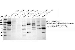 Western blot analysis of VEGF Receptor 2 using anti-VEGF Receptor 2 antibody (ABIN5693262).