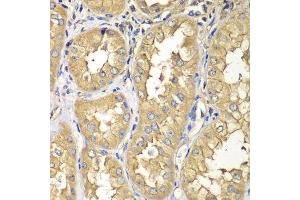 Immunohistochemistry of paraffin-embedded human kidney using RAB5C antibody. (Rab5c antibody  (AA 1-216))