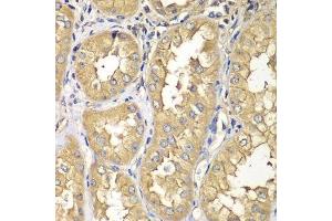 Immunohistochemistry of paraffin-embedded human kidney using RAB5C antibody. (Rab5c antibody  (AA 1-216))