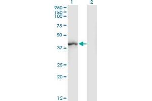 Western Blot analysis of SGOL1 expression in transfected 293T cell line by SGOL1 monoclonal antibody (M01), clone 3C11. (Shugoshin antibody  (AA 1-292))