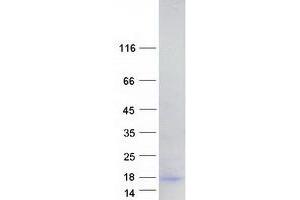 Validation with Western Blot (HOPX Protein (Transcript Variant 3) (Myc-DYKDDDDK Tag))