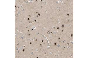 Immunohistochemical staining of human cerebral cortex with FNDC3B polyclonal antibody  shows strong nuclear and moderate cytoplasmic positivity in neuronal cells at 1:20-1:50 dilution. (FNDC3B antibody)