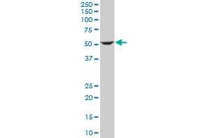 ILK monoclonal antibody (M01), clone 4F10. (ILK antibody  (AA 341-452))
