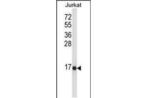 Western blot analysis in Jurkat cell line lysates (35ug/lane). (Tachykinin 3 antibody  (AA 54-83))